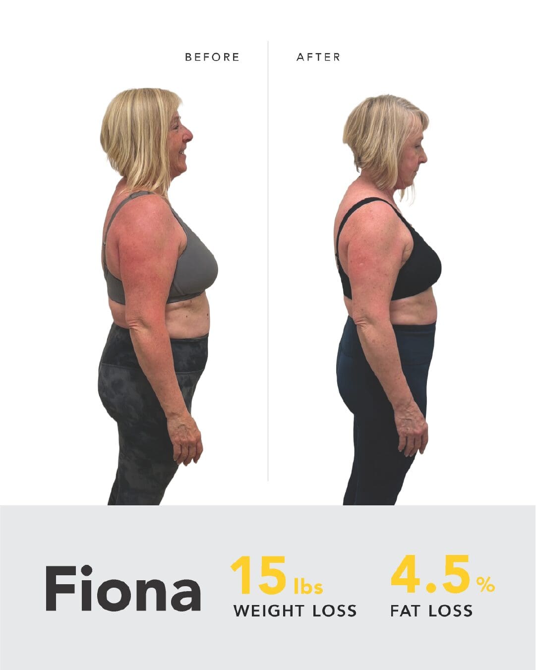 2507 - Fiona - POST
